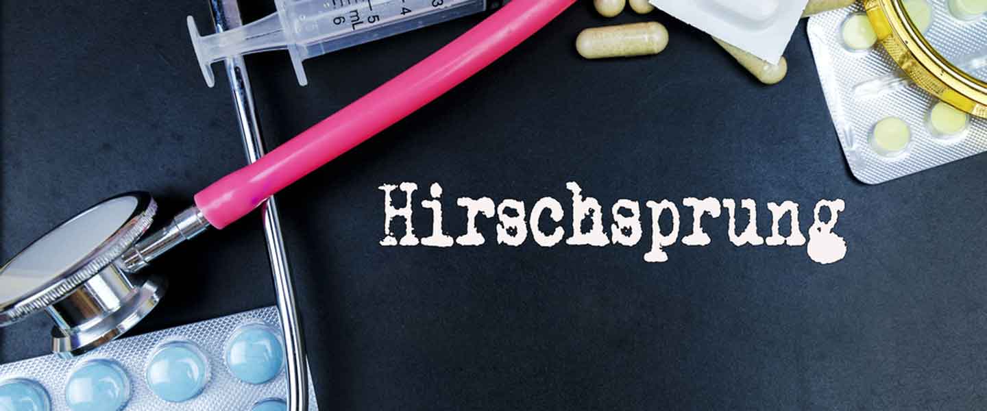 Hirschsprung hastalığı