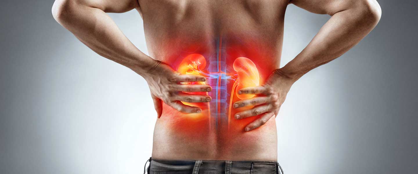 Böbrek ağrısı nedir? Böbrek ağrısı belirtileri nelerdir?