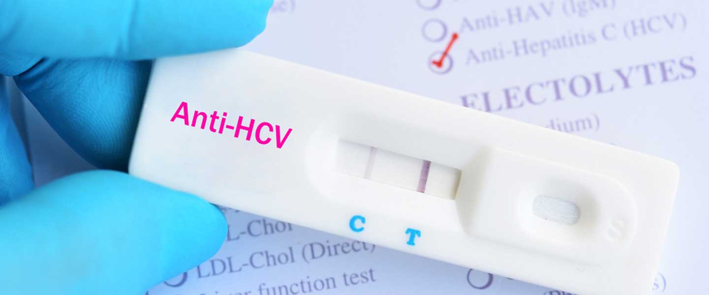 Anti HCV