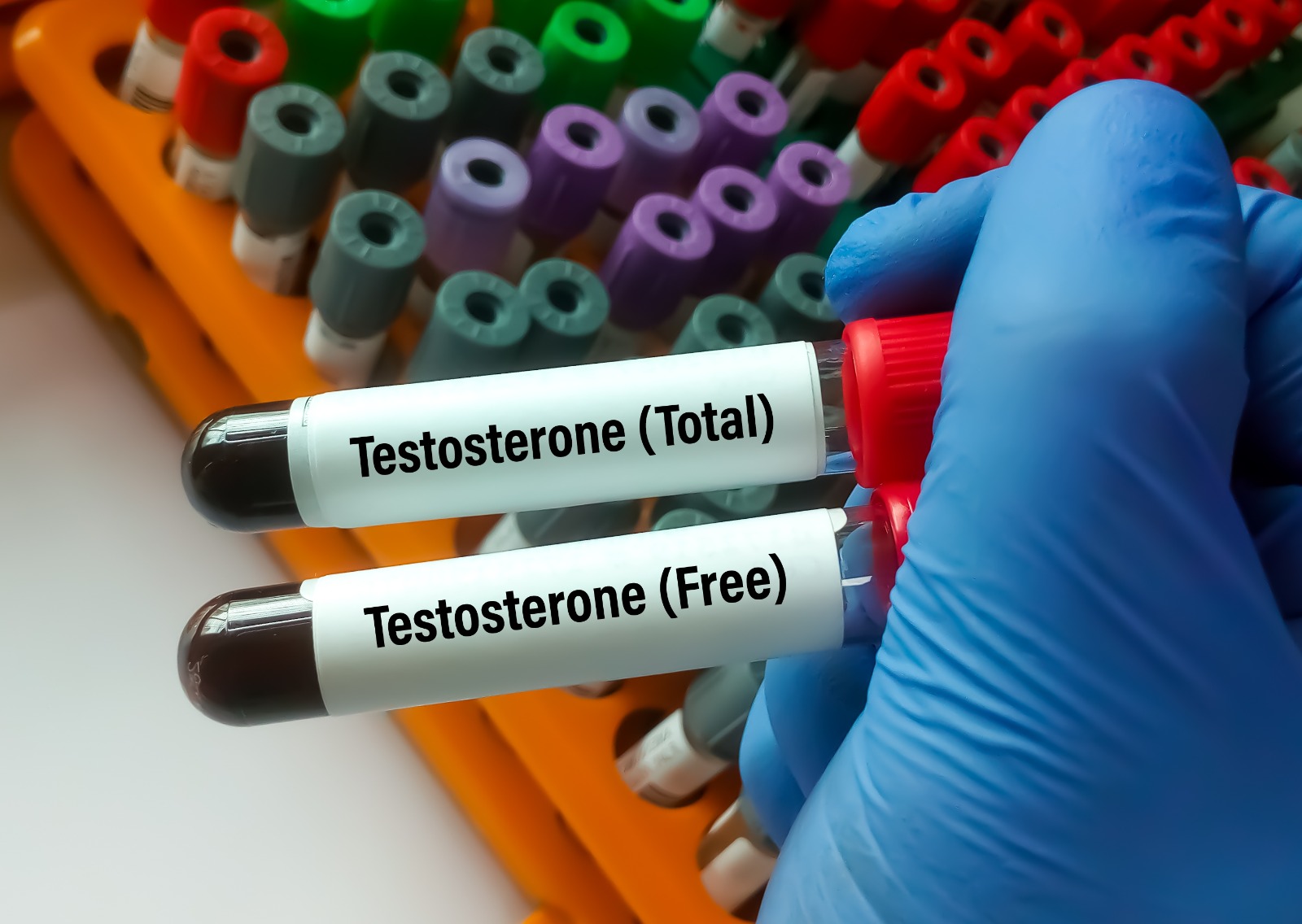 Total Testosteron
